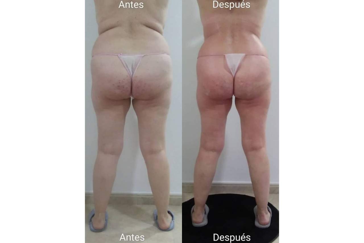 Triple R es el tratamiento reductor en Valencia diseñado por Vanesa Vendrell