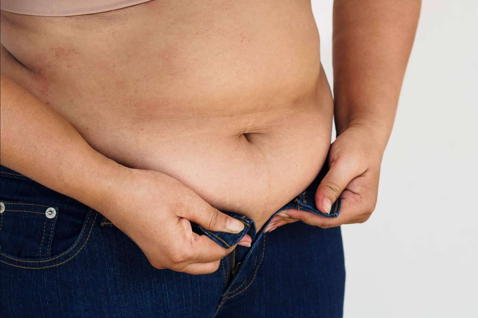 ¿Cuál es la diferencia entre la hidrolipoclasia convencional y la hidrolipoclasia 4D en Clínica Ciscar?