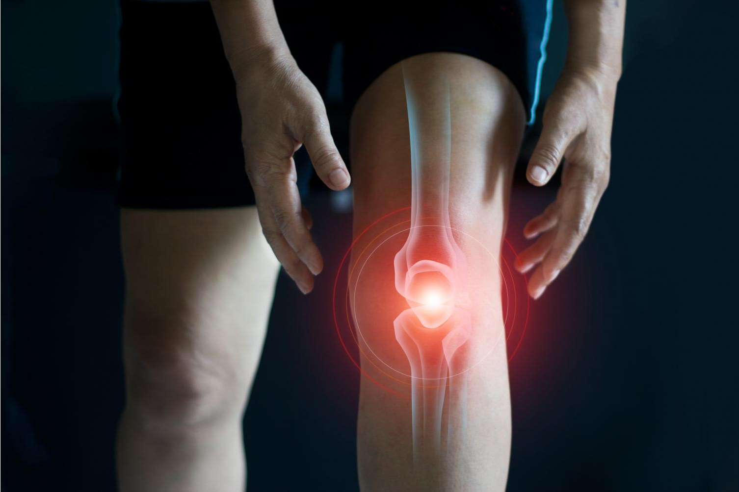 Novonatur: colágeno con silicio como suplemento vitamínico para proteger los huesos y los ligamentos