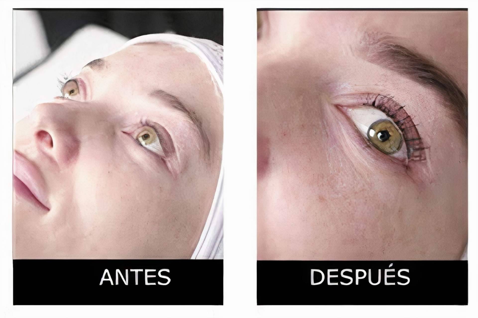 Lash Bomb, el lifting de pestañas de la empresa La Boutique de la Belleza