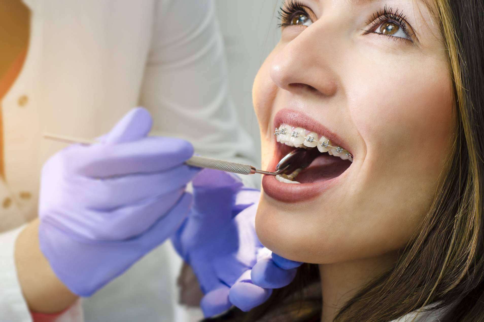 Tratamiento de ortodoncia con brackets en Helident Clínica Dental