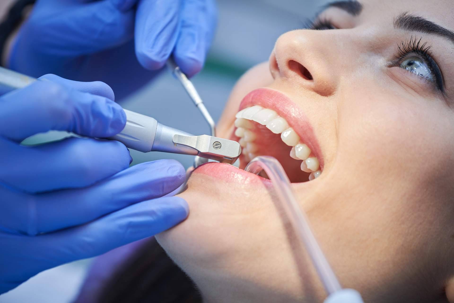 Helident Clínica Dental destaca la importancia de las limpiezas dentales profesionales