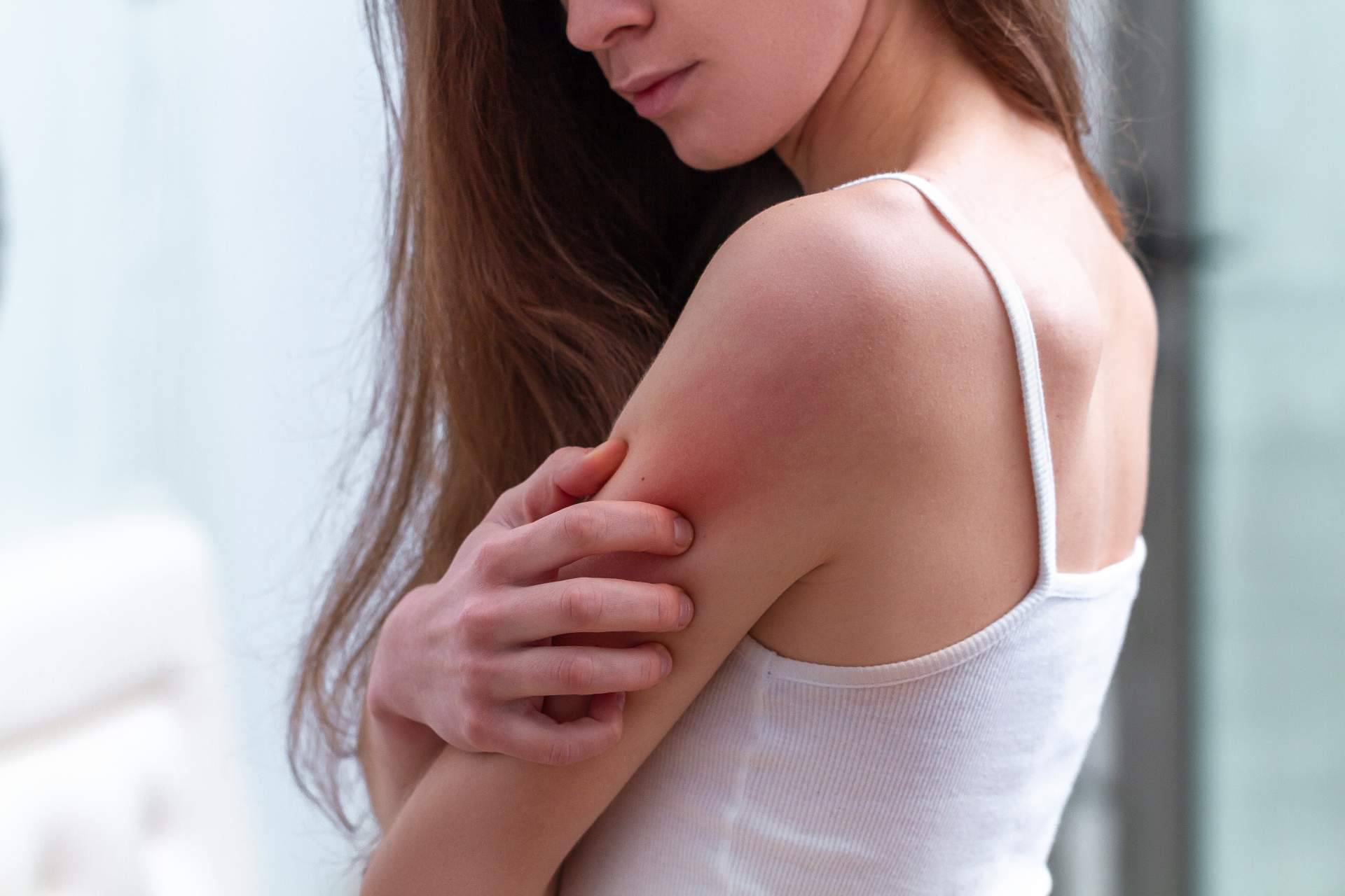 Adquirir un tratamiento natural psoriasis corporal sin cortisona en Laboratorio Géomer