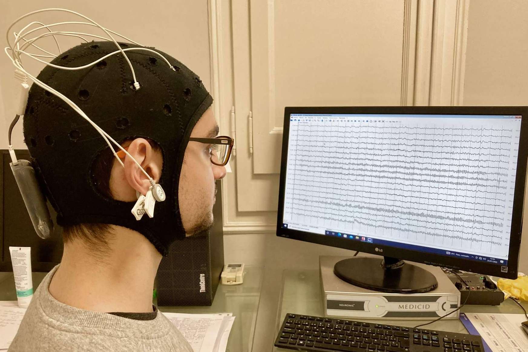 Los tratamientos de neuromodulación aceleran la recuperación tras sufrir un ictus