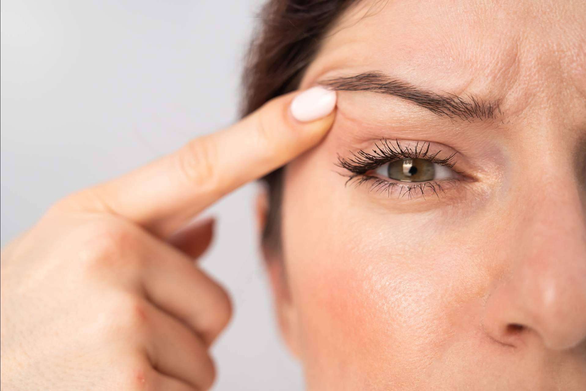 Blefaroplastia sin cirugía con el plasma láser de Alluring Clinic