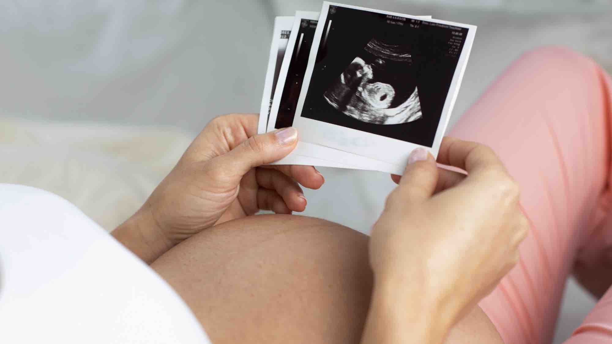 ¿Cuántos embriones hay que transferir en la fecundación in vitro?