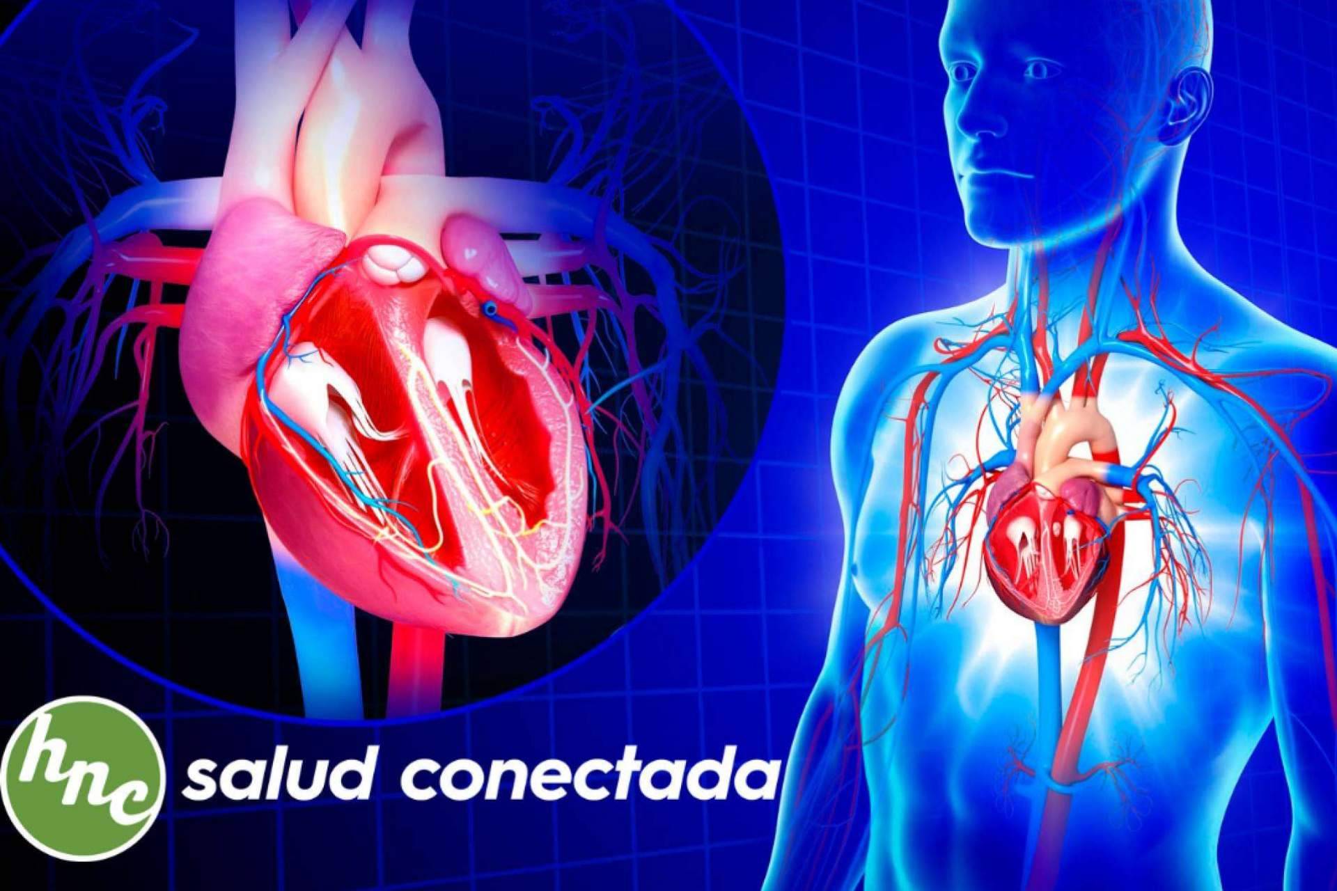 El software de cardiología desarrollado por Health Net Connections